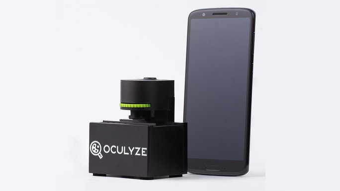 The picture shows a smartphone and a very small microscope developed by the company Oculyze